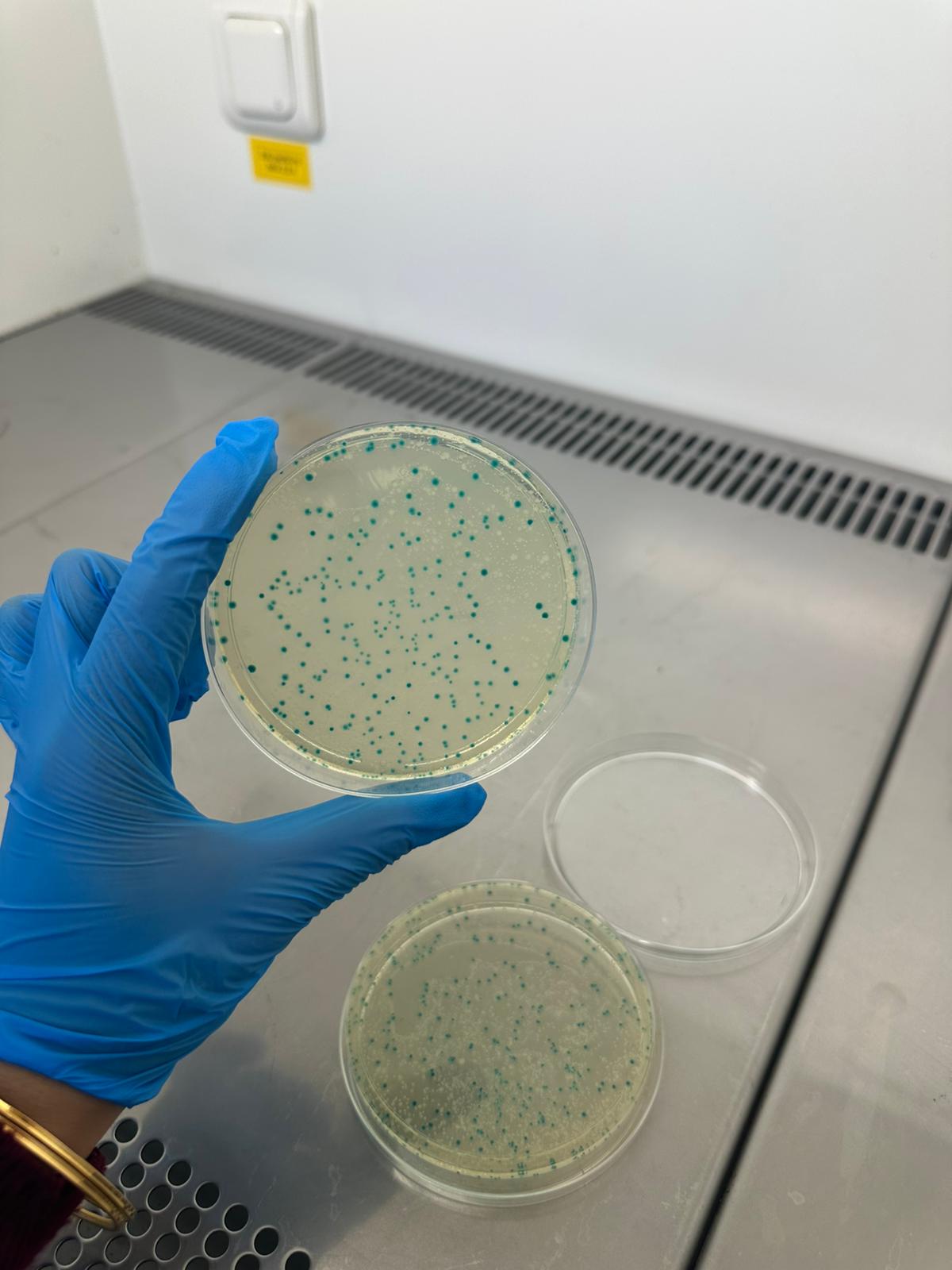 Kromojenik besiyerinde mavi-yeşil koloniler — suda Escherichia coli